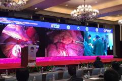 2019 | IFSO APC Meeting, Guangzhou (China)